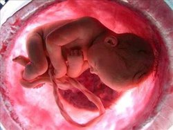 فریز تخمک و اسپرم برای حفظ باروری دختران و پسران مجرد + جزییات
