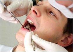 بهداشتکاران جای دندان‌پزشکان را می‌گیرند؟