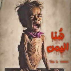 جنگ یمن ماحصل ناتوی غربی و عربی با چراغ سبز آمریکا