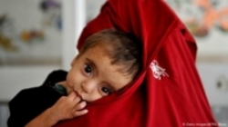 مرگ بر اثر گرسنگی در کمین کودکان افغانستان
