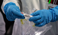 سازمان جهانی بهداشت: در جهان ۷۰ واکسن برای کرونا در حال ساخت است