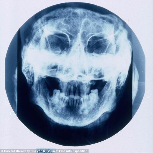 افشای راز مومیایی 4 هزار ساله