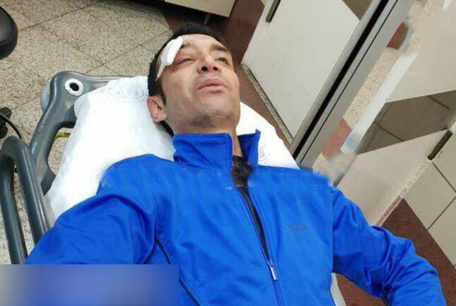 مصدومیت شدید برای آقای گل استقلالی ها/عکس مصدومیت شدید برای آقای گل استقلالی ها/عکس