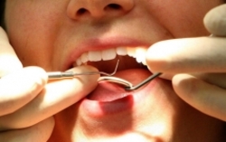 پیش‌بینی اختلالات روانی از روی مینای دندان