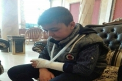 تنبیه بدنی یک دانش‌آموز در همدان منجر به آسیب دست وی شد