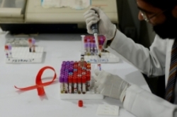 تزریق ماهانه داروهای HIV اثربخش است