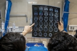 بروز سالانه تا ۸هزار مرگ مغزی در کشور ورود  اهدای عضو  به کتاب‌های درسی