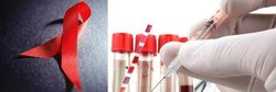 نتایج امیدبخش تست واکسن HIV روی نمونه انسانی