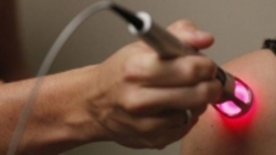 درخواست انجمن متخصصان پوست برای شناسنامه‌دار شدن دستگاه‌های لیزر وارداتی