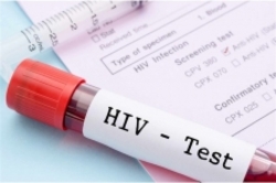 نگرانی از افزایش موارد انتقال HIV از طریق رابطه جنسی