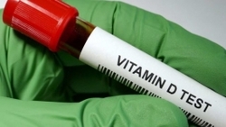 کمبود ویتامین D به صورت معضل جهانی در تمام کشورها مطرح است