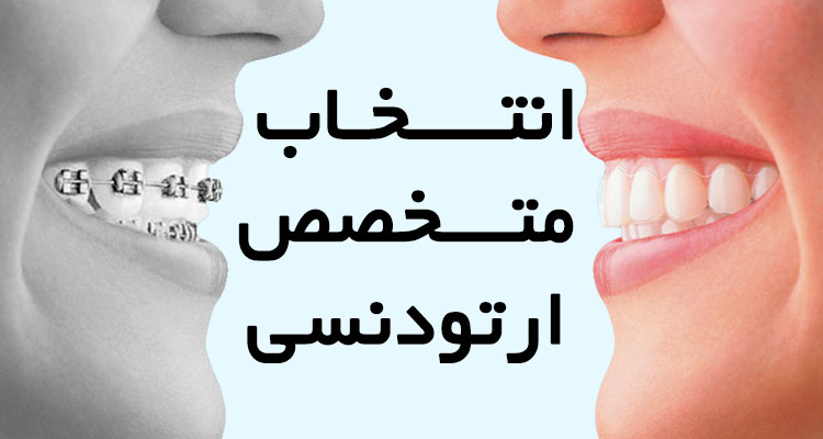 انتخاب متخصص ارتودنسی انتخاب متخصص ارتودنسی