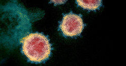 آخرین وضعیت کرونا ویروس در خاش تشریح شد