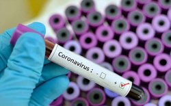 افزایش تشخیص کروناویروس به ۱۸۰۰ آزمایش در روز توسط انستیتو پاستور ایران