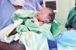 تولد نوزاد متولد شده از مادر مبتلا به کرونا در ساوه