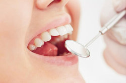 رفع مشکلات بهداشت دهان و دندان ۶۰ درصد از دانش‌آموزان پایه ششم