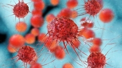 هشدار نسبت به عوارض نوعی داروی سرطان در ژاپن