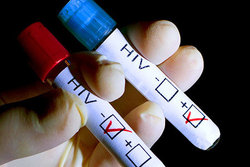 توزیع کیت‌های تست تشخیص «ایدز» در داروخانه‌ها به کجا رسید؟