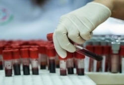 نخستین سانتریفیوژ بانک خون در کشور ساخته می‌شود