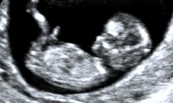 سونوگرافی از جنین برای یادگاری، ممنوع