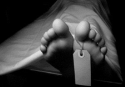 مرگ یک دختر ۱۸ ساله در پی عمل بینی