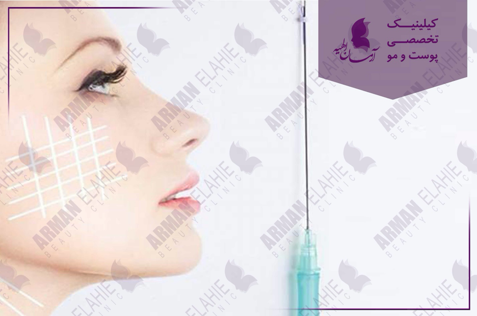 لیفت با نخ جایگزین روش های ترسناک عمل های جراحی همچون عمل بینی لیفت با نخ جایگزین روش های ترسناک عمل های جراحی همچون عمل بینی