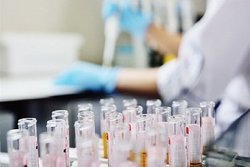 توضیحات شورای هماهنگی ساخت داروی "فاویپراویر" درباره آغاز کارآزمایی بالینی برای درمان کرونا