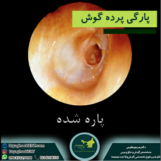 5 متد  5 متد