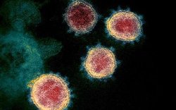 آیا ویروس کرونا از راه فاضلاب و توالت فرنگی منتقل می‌شود؟