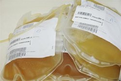 نیاز کلانشهرها به پلاسمای بهبودیافتگان کرونا   درخواست اهدای خون همه گروه‌های خونی