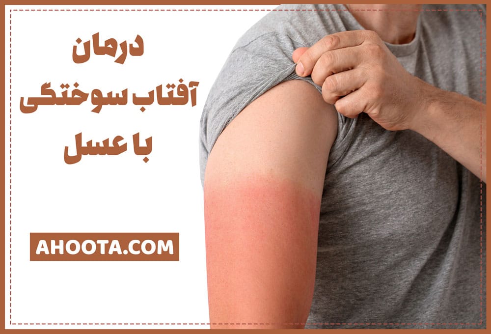ماسماسک عسل برای پوست و زیبایی، خواص و نحوه استفاده ماسماسک عسل برای پوست و زیبایی، خواص و نحوه استفاده