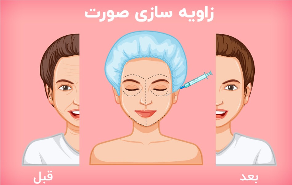 دکتر امیر هاشملو و تکنیک های غیر تهاجمی دکتر امیر هاشملو و تکنیک های غیر تهاجمی