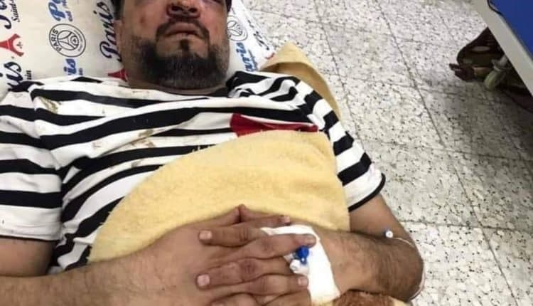 قهرمان آسیا توسط اراذل و اوباش کشته شد/عکس