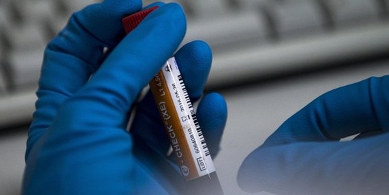 بازی‌های کشورهای اسلامی بدون نمونه مثبت/آغاز نمونه‌گیری دوپینگ در فوتبال از هفته دوم