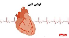 آریتمی قلبی چیست، چه علائمی دارد و راه های پیشگیری از آن چیست؟