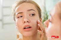 بهترین روش برای ترمیم پوست صورت