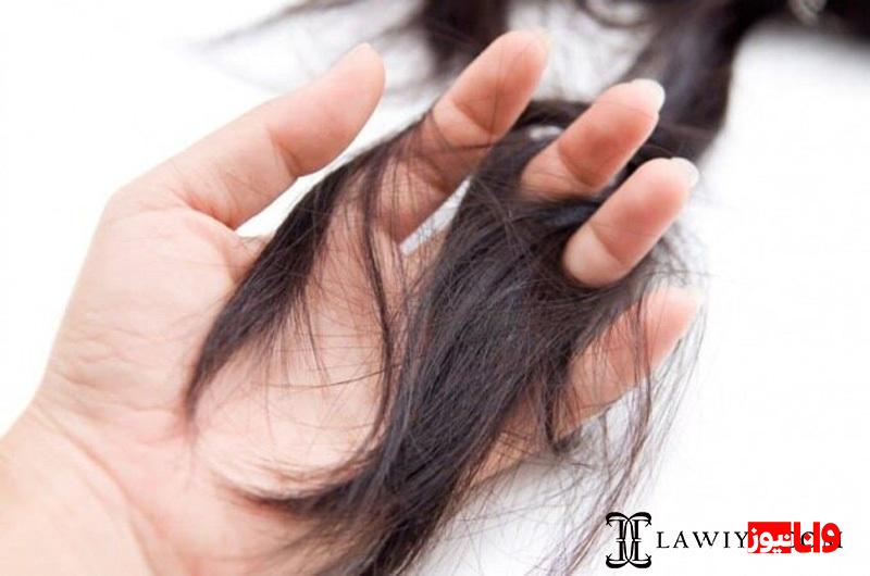 قرص پریورین چگونه به درمان ریزش مو کمک می کند؟ قرص پریورین چگونه به درمان ریزش مو کمک می کند؟