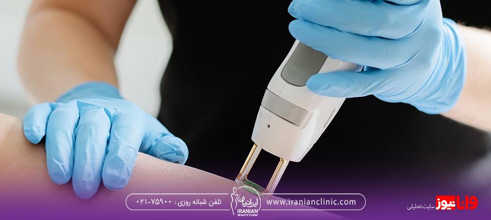 آیا لیزر موهای زائد باعث نازایی می شود؟ آیا لیزر موهای زائد باعث نازایی می شود؟