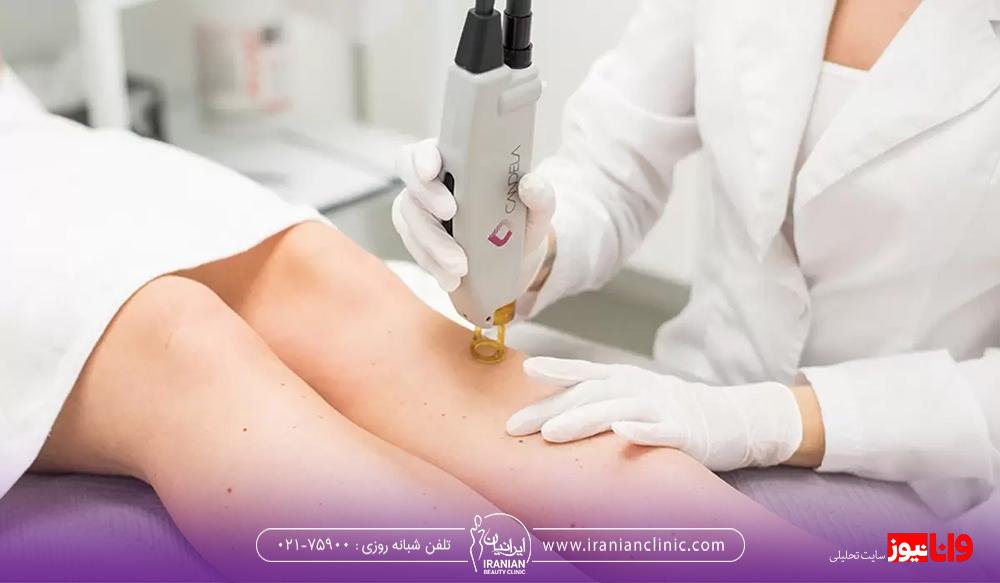 آیا لیزر موهای زائد باعث نازایی می شود؟ آیا لیزر موهای زائد باعث نازایی می شود؟