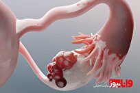 از کجا بفهمیم کیست داریم؟