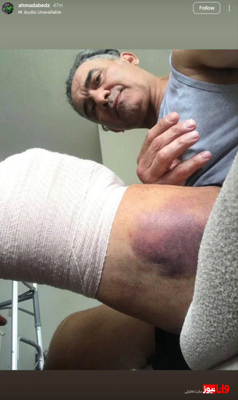 پیام دردناک احمدرضا عابدزاده از ینگه دنیا + عکس پیام دردناک احمدرضا عابدزاده از ینگه دنیا + عکس