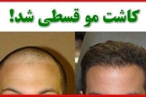 یه روزه مو بکار؛ قسطی بدون بهره