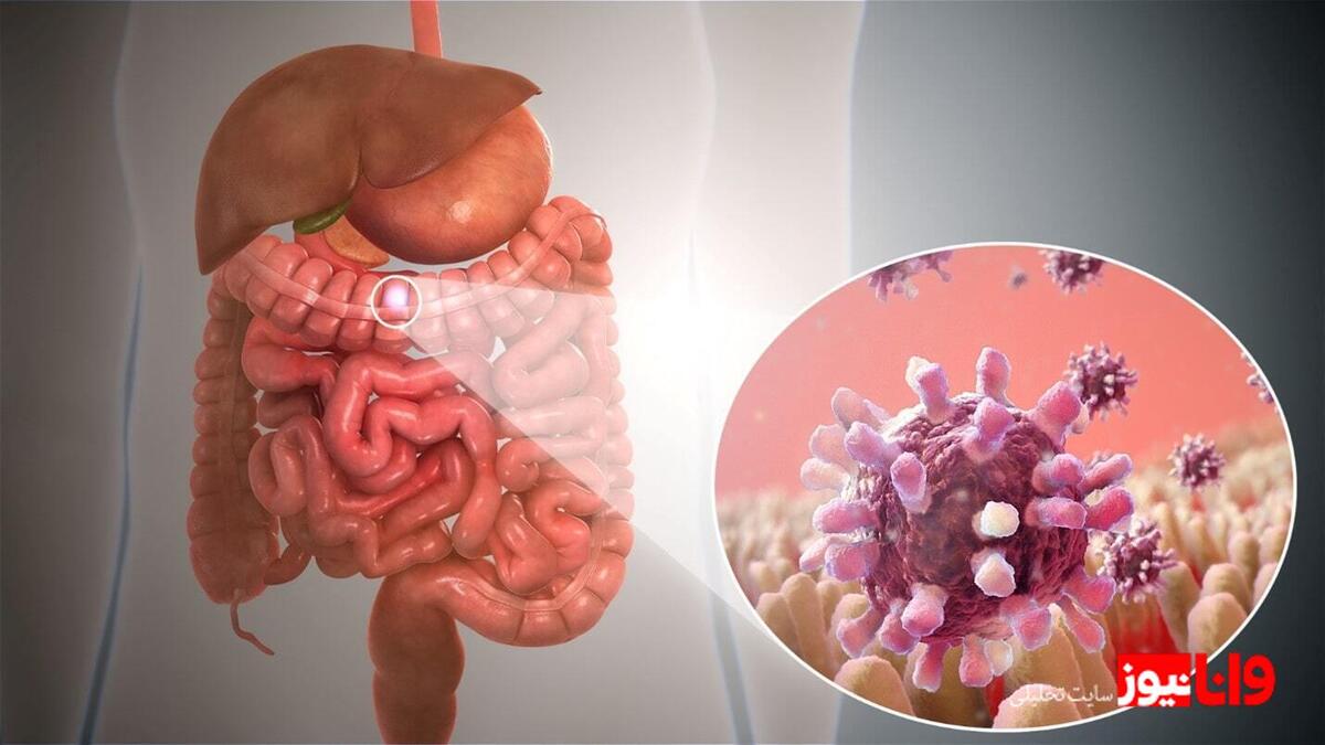 آنفولانزای معده چیست؟