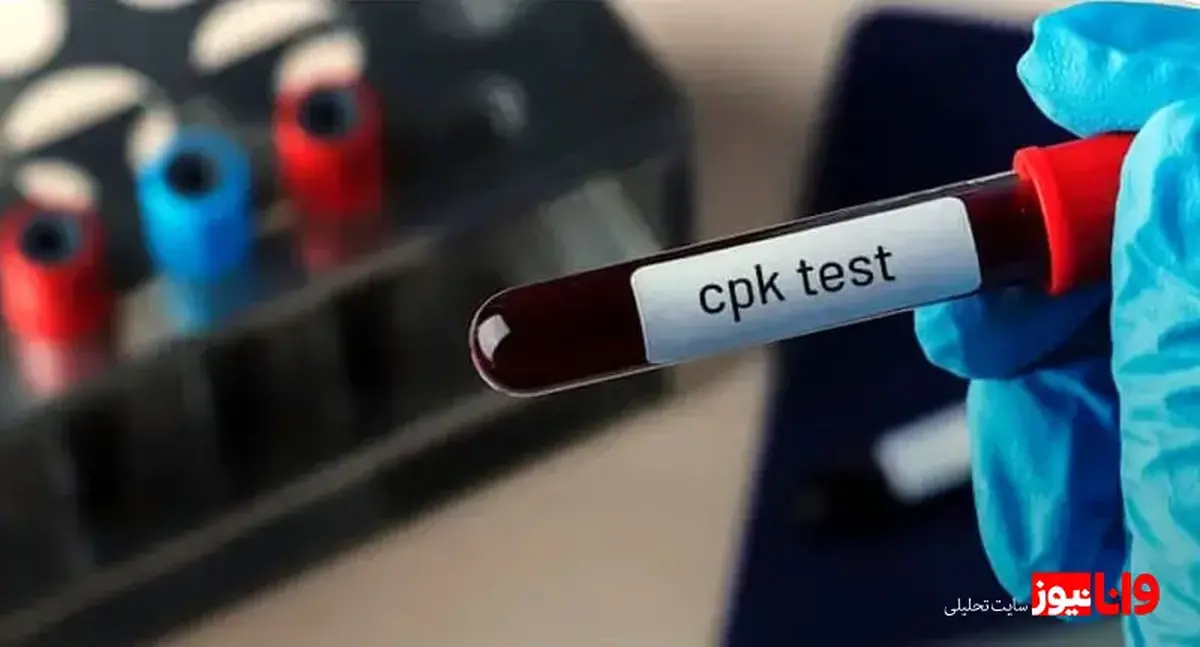 CPK در آزمایش خون چیست؟