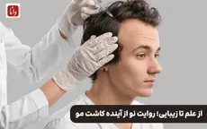 از علم تا زیبایی؛ روایت نو از آینده کاشت مو